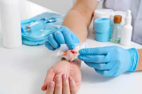 Hay casos especiales para curar heridas